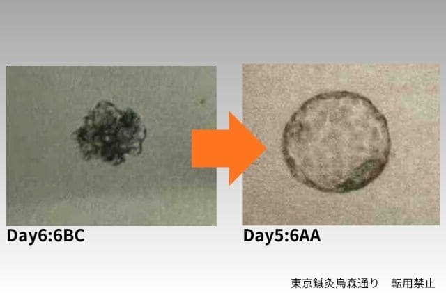 良好胚盤胞取得の記録東京鍼灸
