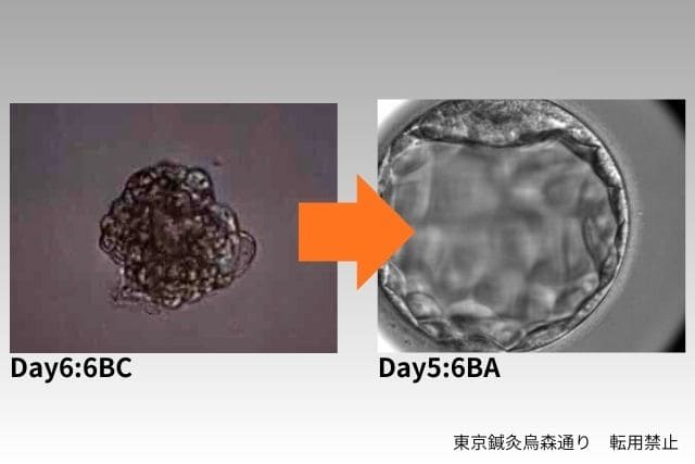 良好胚盤胞取得の記録2東京鍼灸