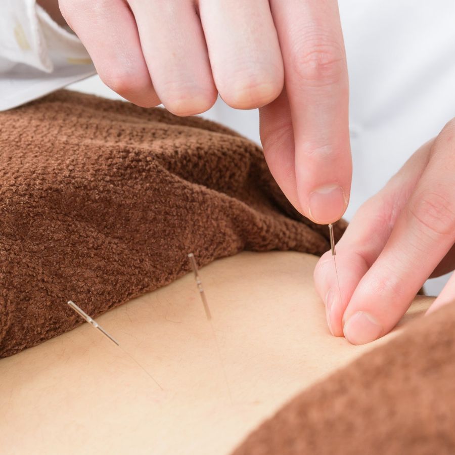 鍼灸施術の様子