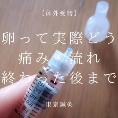 採卵って実際どう？痛み・流れ・終わった後まで全部リアルに解説
