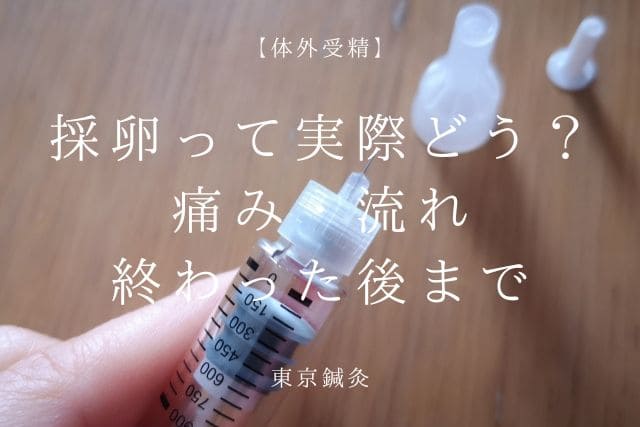 採卵って実際どう？痛み・流れ・終わった後まで全部リアルに解説